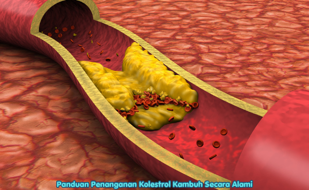 Panduan Penanganan Kolestrol Kambuh Secara Alami